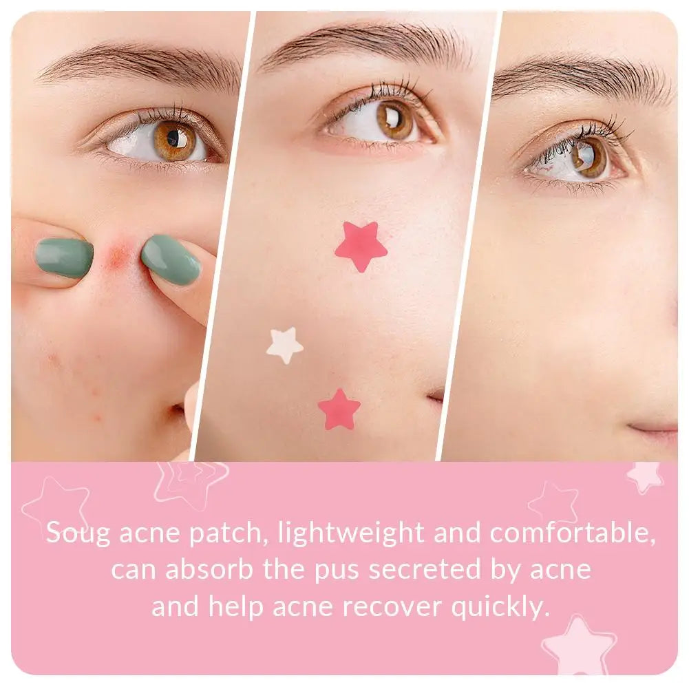240Pcs Cute Star Acne/Pimple Patch Acne Treatment Stickers Invisible Acne Stars Cover Face Spot Removal Pimple Patch Skin Care